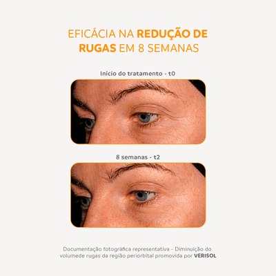 ANTES X DEPOIS
